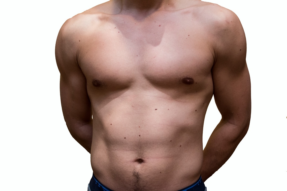 Однополая любовь убивает здоровье