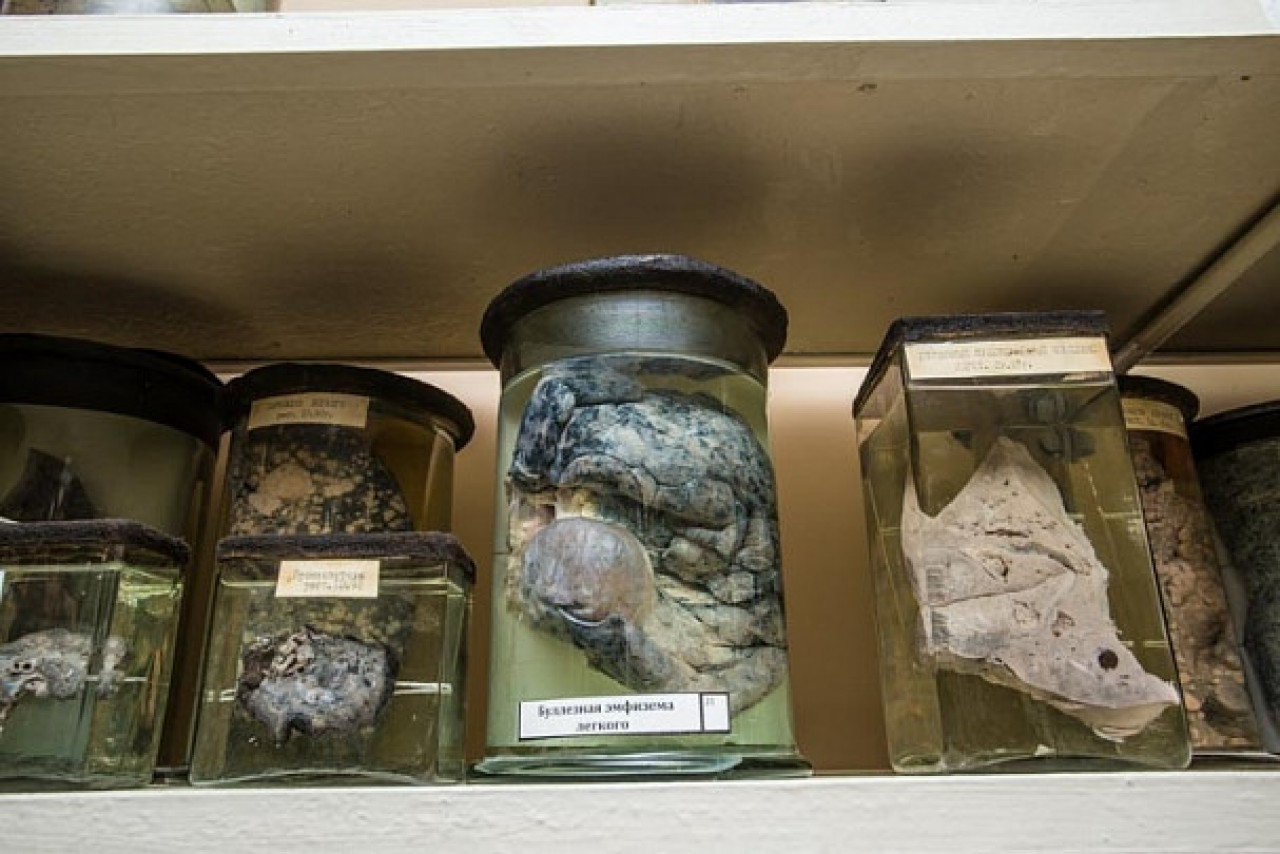 Жизнь в городе страшнее яда сигареты