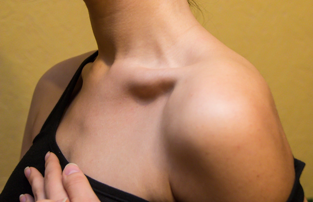 Кого комары любят больше 