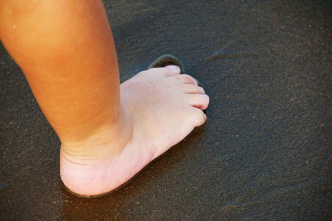 Ребенок стал инвалидом по вине врачей