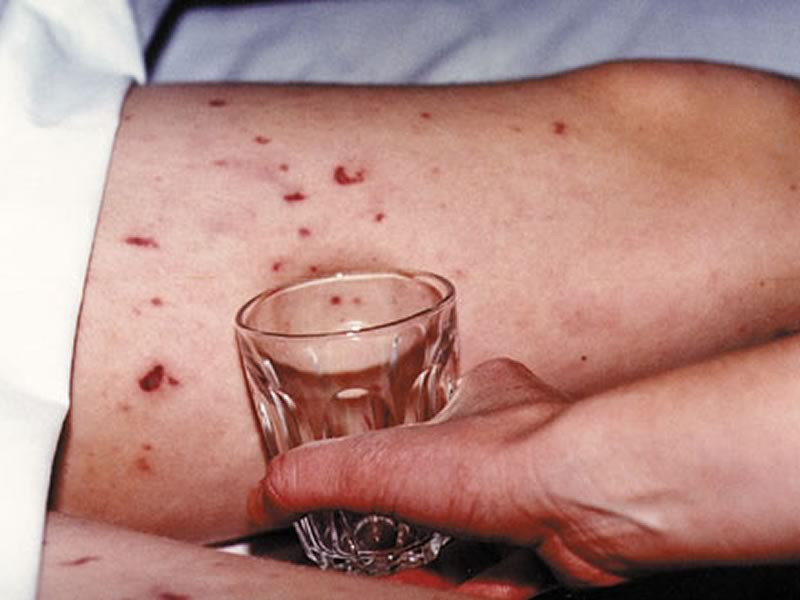 Педиатр: собак и кошек приморцы прививают, а своих детей - нет