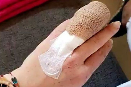 Линдси Лохан покалечилась на отдыхе