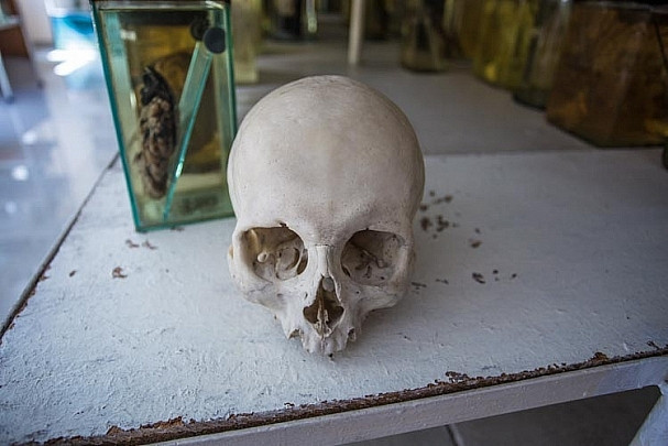 Названы основные причины смерти россиян