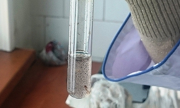 Почему прививку от гриппа нужно делать сейчас