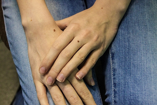 Рак кожи поражает все больше женщин на Сахалине