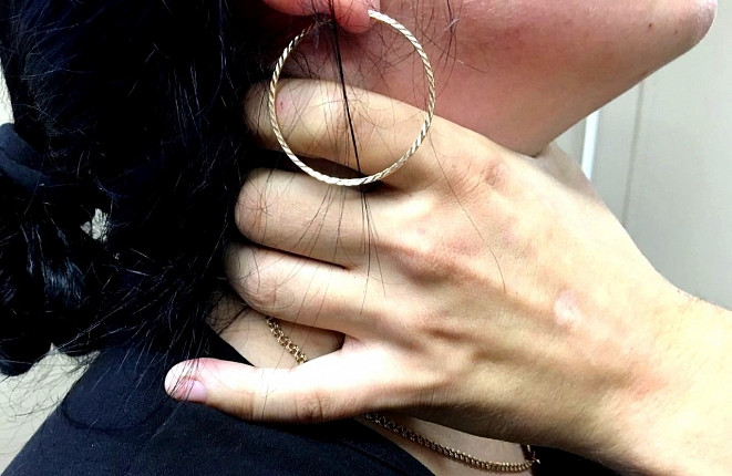 Бактерии полости рта могут вызывать мигрень