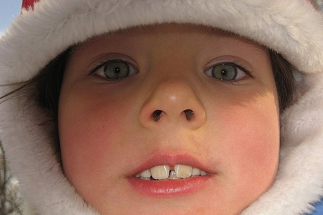 Стоматологи рассказали, что разрушает зубы