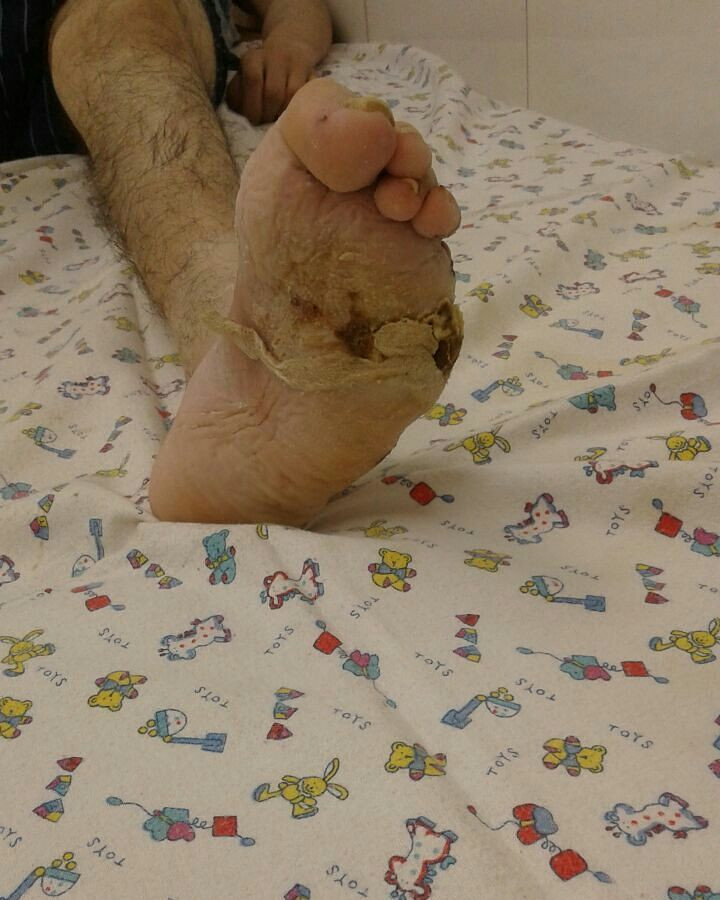 Заболевания «свирепствуют» на Камчатке (фото)