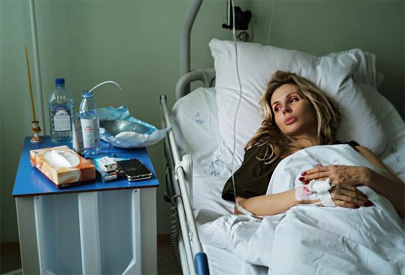 Прооперированная Лобода обратилась к поклонникам
