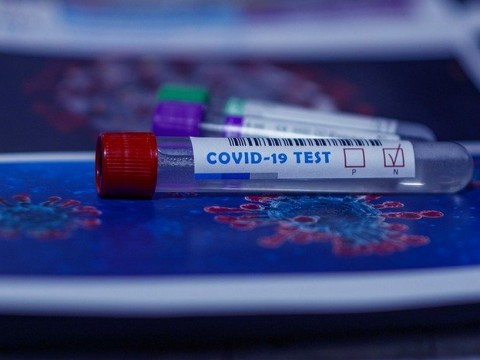 Роспотребнадзор озвучил планы о получении вакцины от коронавируса