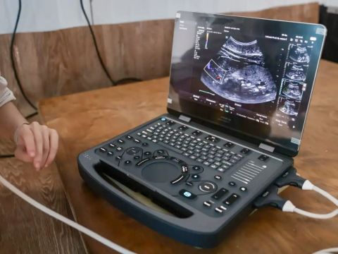 Фото-репортаж: «Восточный Порт»: с заботой о морских млекопитающих